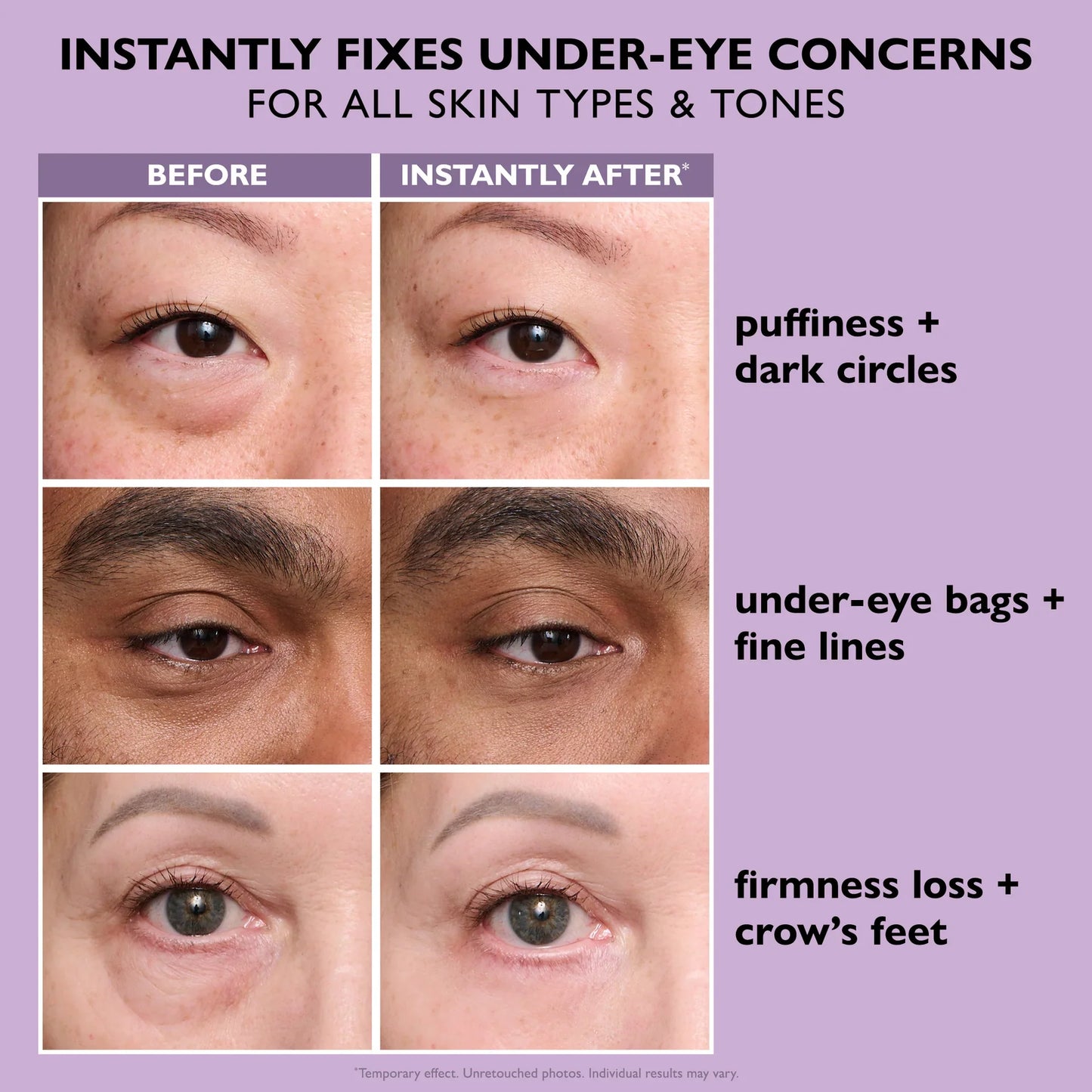 The last day: 48% OFF🏆 Instant Eye Tightener Easy-Wear Formula With Brush Free!